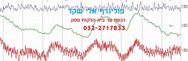 פוליגרף אלי שקד - גל-אור image