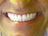 אדיק דנט - מרפאת שיניים חירום 24/7 uploaded image