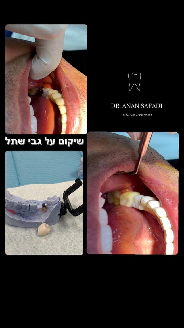מרפאת שיניים ד"ר ספדי ענאן