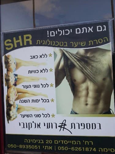 הסרת שיער בטכנולוגית s.h.r