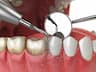 מרפאת שיניים של ד"ר גיזונטרמן ירושלים  Dr. Gizunterman dental clinic