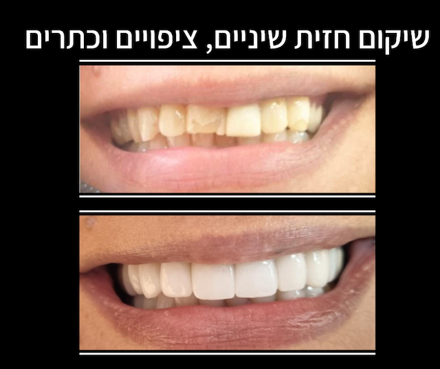 רפואת שיניים Hollywood Smile Medical image