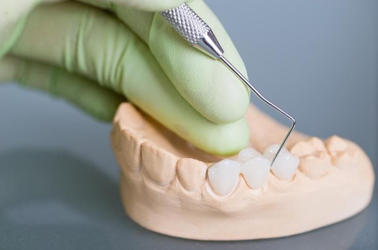 אדי ישראלי מעבדת שיניים - תיקון תותבות עד בית הלקוח image