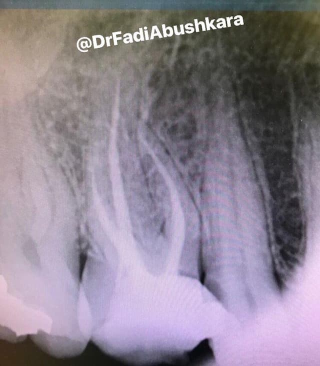 ד"ר פאדי אבו שקארה רופא שיניים image