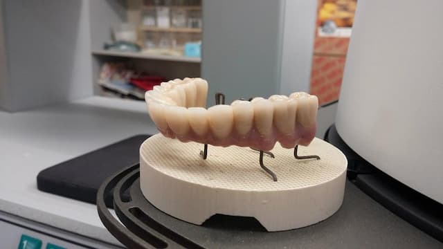 פרידמן מעבדת שיניים - מרכז סריקה וחריטה דיגיטלית image