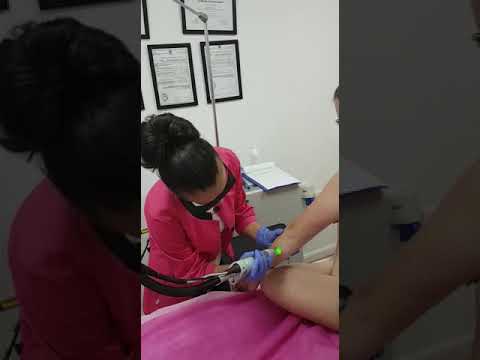 לייטקאר לייזר בע"מ